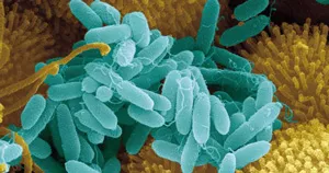 Pseudomonas aeruginosa (pseudomonas aeruginosa) (Pseudomonas) Pseudomonas aeruginosa (pseudomonas aeruginosa)
