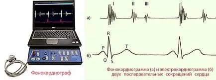 murmur cardiac la adulți cauze, tipuri, simptome si tratament (zgomot) murmur cardiac la adulți cauze, tipuri, simptome și tratament