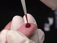 coagularea sângelui apare ca procesul de coagulare a sângelui (sânge) Coagularea sângelui ca are loc un proces de coagulare a sângelui