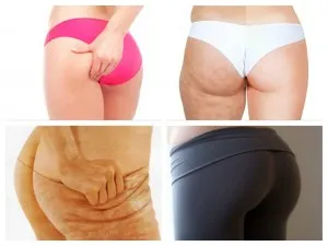Scoateți fese (femur) (repetare poziția de pornire) Eliminați fese (femurale)