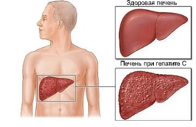 ficat Uzi care arată indicatorii de decodare și rata