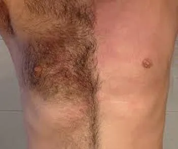 Waxing