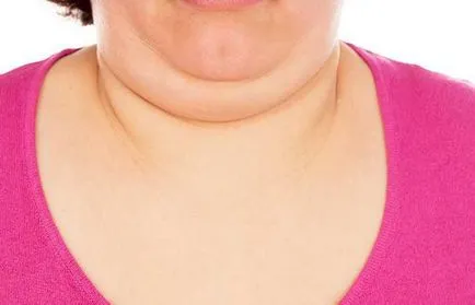 Chin cauzele femeilor