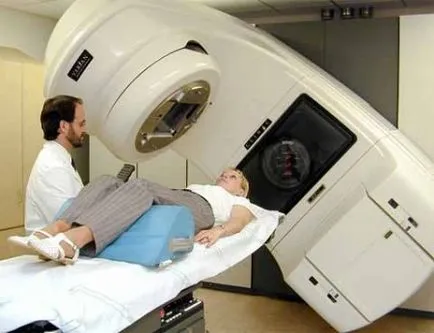 Chimioterapie pentru cancer rectal tipuri, eficacitatea și consecințele acestora