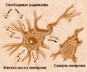 comă lumească (moarte cerebrală) criterii, diagnostic, simptome, tratament
