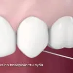ata dentara, modul de utilizare și de a alege