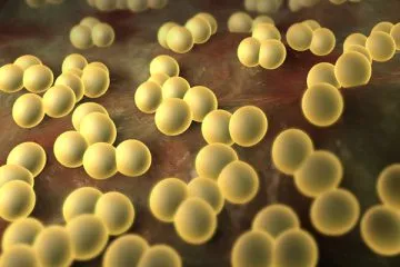 Staphylococcus aureus în gât simptome, tratament fotografie bacteriofag