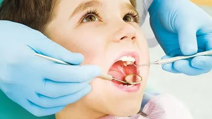 ata dentara, modul de utilizare și de a alege