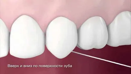 ata dentara, modul de utilizare și de a alege