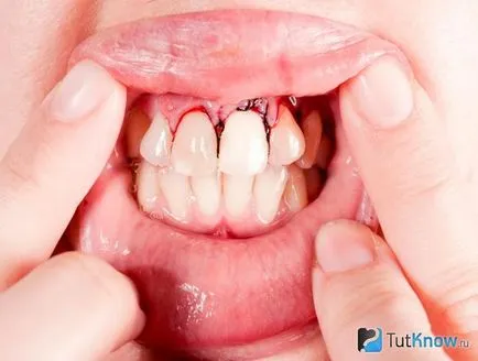 numirea ata dentara, selectarea și aplicarea normelor