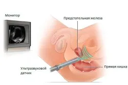 Ultrasunete tipuri de mașini și principiul de funcționare (primul pe SUA) tipuri de mașini cu ultrasunete și principii de funcționare