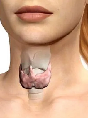 Tiroidiană fotografie Anatomia, în cazul în care glanda tiroidă și structura sa