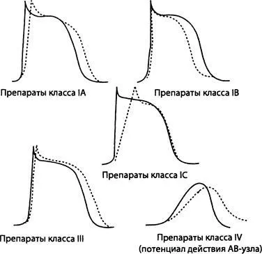 Lista antiaritmice de instrumente, clase, acțiune