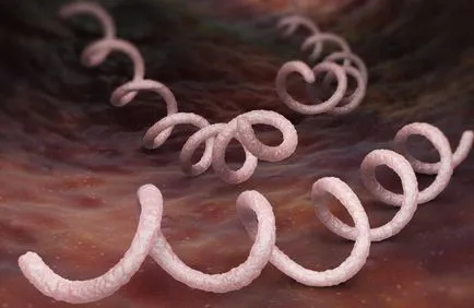 Anticorpii la Treponema pallidum - l