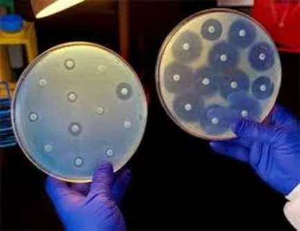 Antibioticele în inflamarea rinichilor și a vezicii urinare comprimate