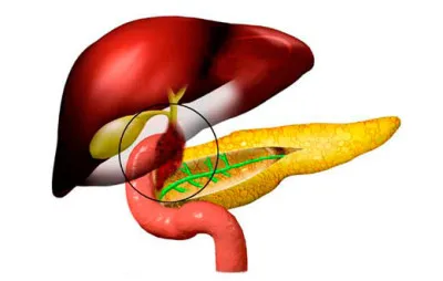 Boala lui Botkin este că acesta este o hepatita, iar consecințele pentru femei și bărbați (Botkin) Boala lui Botkin este că acesta este o hepatita, iar consecințele pentru femei și bărbați