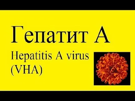Boala lui Botkin este că acesta este o hepatita, iar consecințele pentru femei și bărbați (Botkin) Boala lui Botkin este că acesta este o hepatita, iar consecințele pentru femei și bărbați