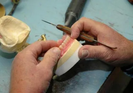 Clasp proteze etape de fabricație și Tehnologie (de fabricație) Clasp proteze etape de fabricație și Tehnologie