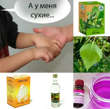 Ce se întâmplă dacă palmele transpirate