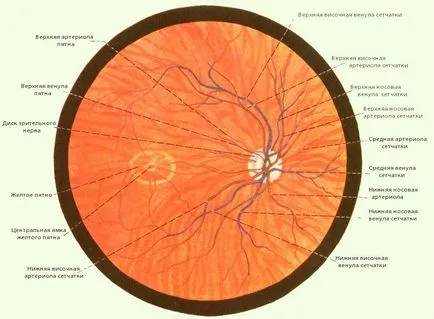 Ce este angiopatia vaselor retiniene (ochi) Ce este angiopatia a ochilor retinei