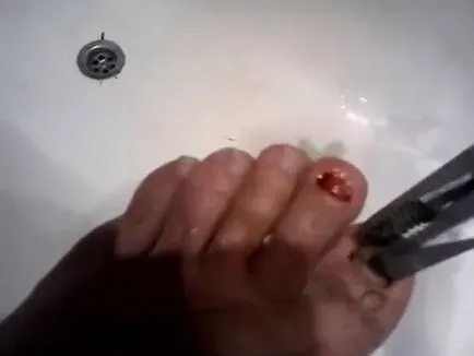 Ce este mangostan