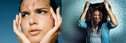 Dermatillomaniya sau cules pielii - cum să scapi