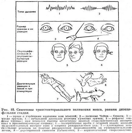 Diagnosticul diferențial de stări comatoase