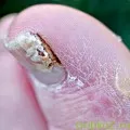 Ce este Scoala Diabet