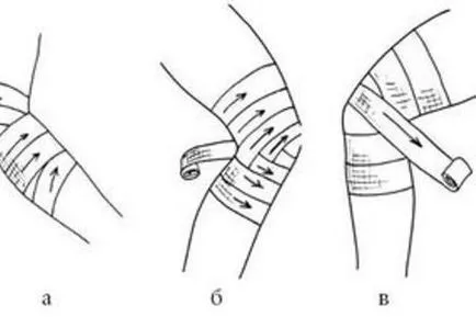 bandaj elastic genunchi cu privire la modul de a impune corecte (Bandaje de mare elasticitate) bandaj elastic pe genunchi ca dreptul de a impune