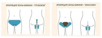 Îndepărtarea părului cu ajutorul unei pensete bikini la domiciliu