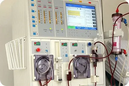 Hemodializa, EUROLAB, urologie
