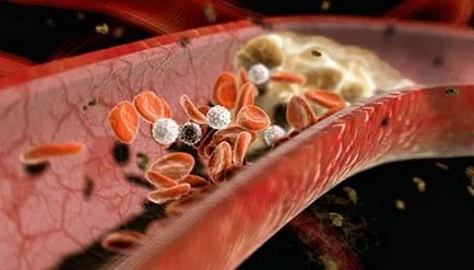 Hipolipemiante efect sunt, medicamente, dieta