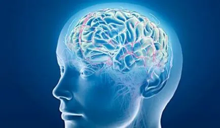 Accident vascular cerebral la copii