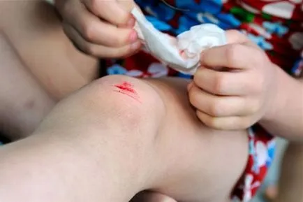 unguent Ihtiolovaya care ajută, instrucțiuni de utilizare