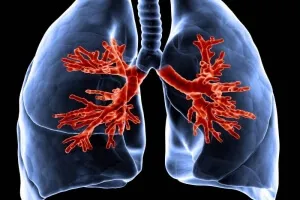 Cum rănit plămâni fata simptome în timpul inhalării la om, tuse (lumina) Cum rănit plămânii simptomele față în timpul inhalării la om, tuse