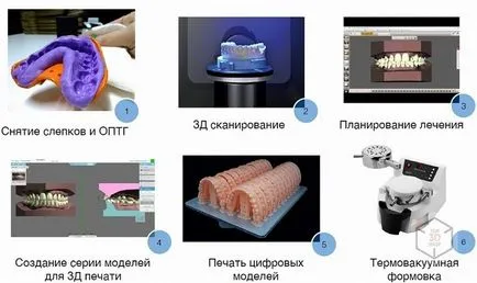 Așa cum am testat aligner de corecție musca directorul nostru (nostru) Așa cum am testat aligner de corecție mușcătură de a directorului nostru