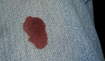 Cum să se spele sângele de pe hainele la domiciliu