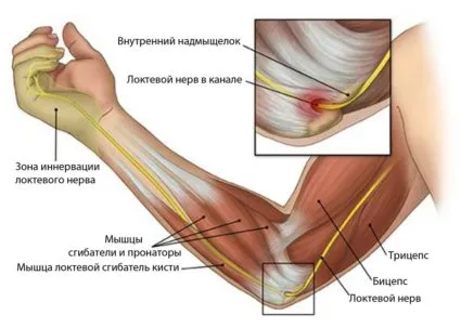 În cazul în care tratamentul mână inflamat În cazul în care tratamentul mână inflamat