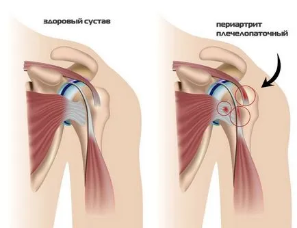 În cazul în care tratamentul mână inflamat