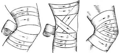Cum de a lega un bandaj elastic, cum se aplica un bandaj elastic