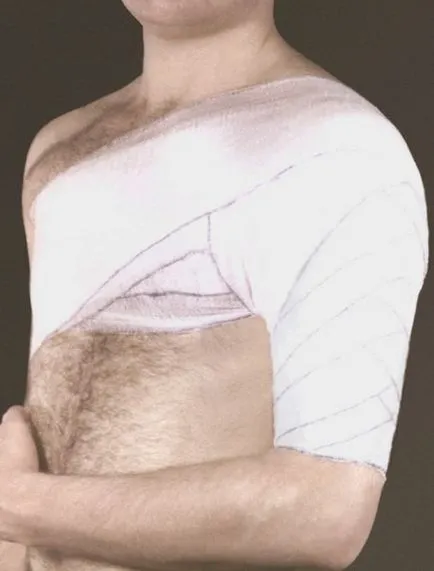Cum de a lega un bandaj elastic, cum se aplica un bandaj elastic
