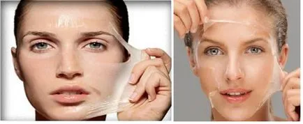 Cum de a elimina ridurile sub ochii lui, cum să scapi de riduri faciale sub ochi la domiciliu