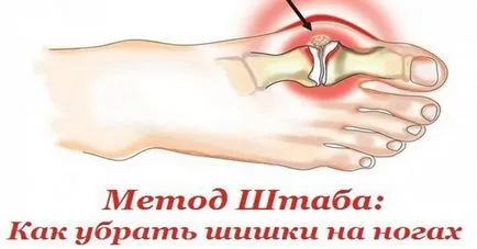 Cum de a elimina mici umflături pe metoda picioarelor personalului, mereu în formă!