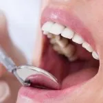 Cum de a consolida smalțul dentar 5 sfaturi! (Dinti) Cum de a consolida smalțul dentar 5 sfaturi!