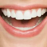 Cum de a consolida smalțul dentar 5 sfaturi! (Cererea de durere Frica) Cum de a consolida smalțul dentar 5 sfaturi!