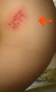 Ce ar trebui să fac în cazul în care fierbe Ce ar trebui să fac în cazul în care fierbe