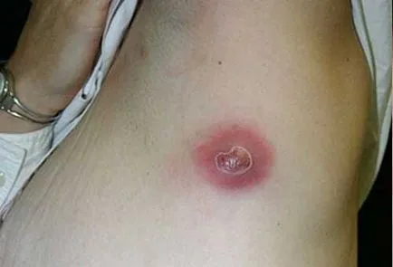 Ce ar trebui să fac în cazul în care fierbe Ce ar trebui să fac în cazul în care fierbe