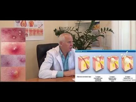 Ce ar trebui să fac în cazul în care fierbe