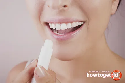 Cum de a vindeca buzele crapate la domiciliu (buze) Cum de a vindeca buzele crapate la domiciliu