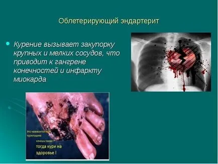 Fotografii despre pericolele fumatului pentru studenți (fumat) Imagini cu privire la pericolele fumatului pentru elevi